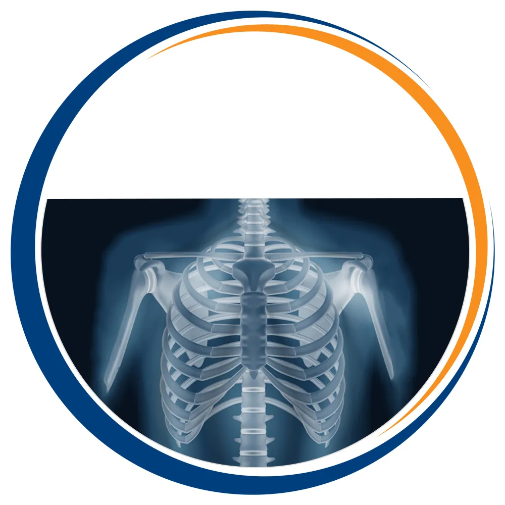 SPINE