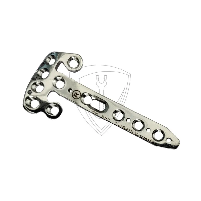 Distal Radius RIM Plate