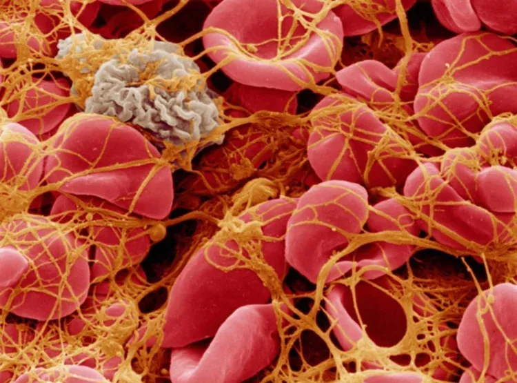 Anti-platelet Drugs